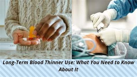 Long Term Blood Thinner Use What You Need To Know About It Our Healtho