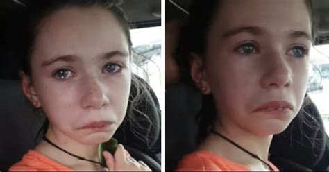 12 Year Old Girl With Disabilities Bitten On Face And Scratched By Bullies Mom Films Plea For