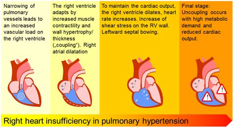 Diagnostics Free Full Text Right Heart Size And Right Ventricular