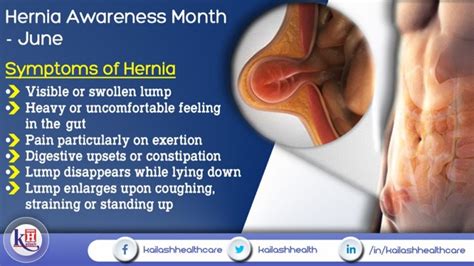 Symptoms Of Hernia Hernia Awareness Month June