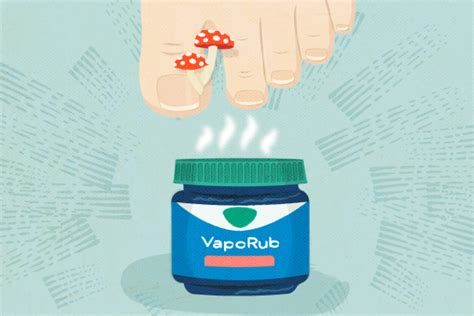How To Use Vicks Vapor Rub Cure Toenail Fungus Nail Ftempo