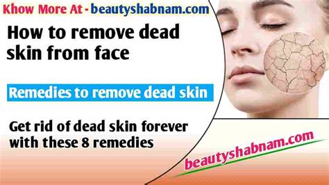 How To Remove Dead Skin From Face Try 8 Remedies To Remove Beautyshabnam