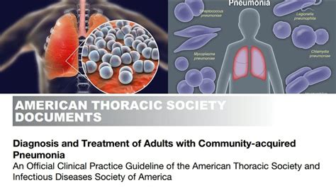 Community Acquired Pneumonia Guidelines Adult Cap Atsidsa Guidelines