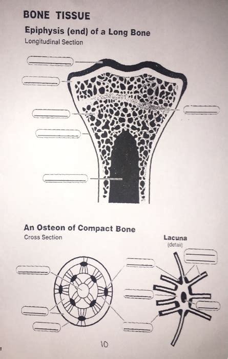 Bone cross section diagram ipad folio cases. Solved: BONE TISSUE Epiphysis (end) Of A Long Bone Longitu ...