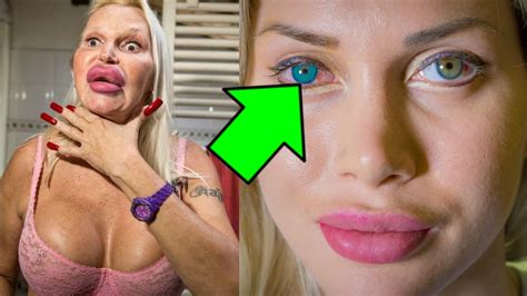 10 People With Extreme Plastic Surgery Addiction Youtube
