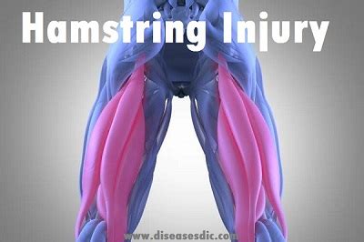 Hamstring Injury Or Strain Grades Of Injury Causes And Complications