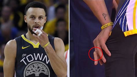 Nba Stephen Curry Dislocates Finger In Golden State Warriors Game 2