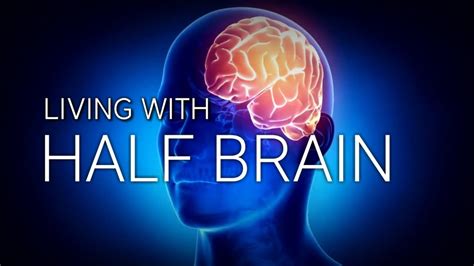 🧠 Living With Half Brain 🤨 Ask Me Science Youtube