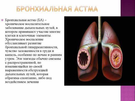 Стол 9 бронхиальная астма - 86 фото Картинка - Стол 9 бронхиальная астма - 86 фото