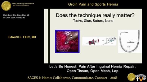 Lets Be Honest Pain After Inguinal Hernia Repair Youtube