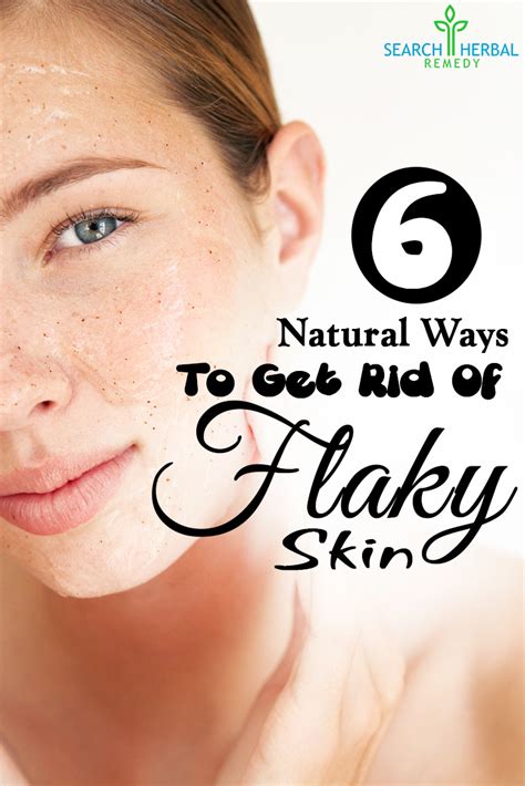 Easy Natural Ways To Get Rid Of Flaky Skin Search Herbal Home Remedy