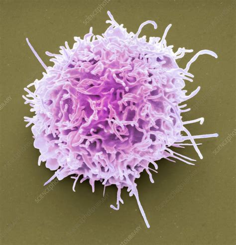 Lymphoma Cancer Cell Stock Image C0458790 Science Photo Library