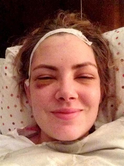 Woman Ignored Brain Tumour For 10 Years Thinking She Was Just Tired