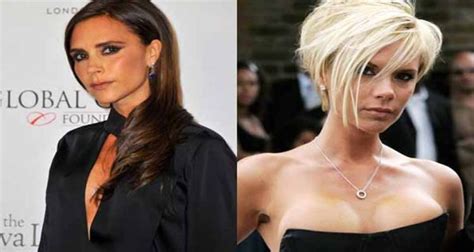 Victoria Beckham Before And After Breast Implants Young Kennel