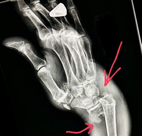 Pin On X Rays
