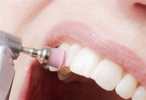Curetaje Dental Clínica Trei