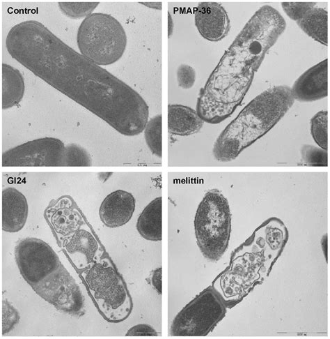Coli, and wove a lovely story of how the e. Transmission electron microscopic micrographs of E. coli ...