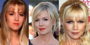 Jennie Garth Plastic Surgery Before And After Pictures 2024