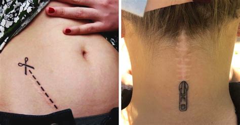 10 Amazing Tattoos That Turn Scars Into Works Of Art Bored Panda