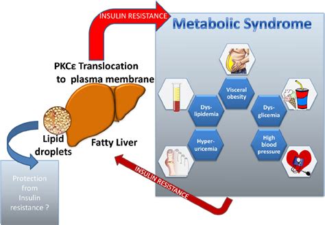 Primacy Of Nonalcoholic Fatty Liver Disease Over Metabolic Syndrome