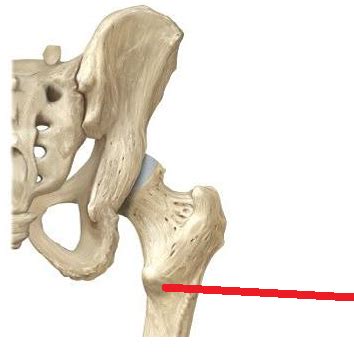 The position of the lesser trochanter close to the head of the femur is one of the defining characteristics of the prozostrodontia. front
