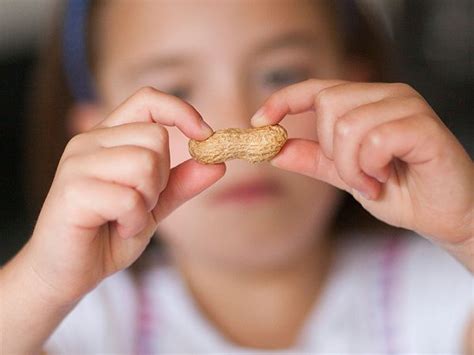 Peanuts For Babies Starting Early May Prevent Allergies Later On