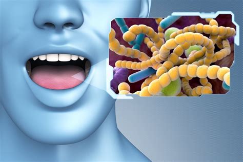 4 Surprising Benefits Of Probiotics For Oral Health Bad Breath Gum