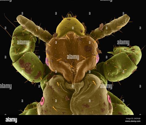 Coloured Scanning Electron Micrograph Sem Of Human Head Louse