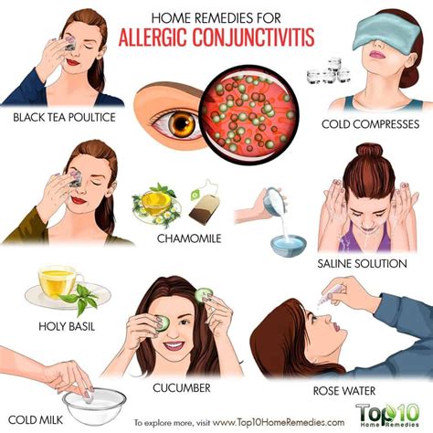 Home Remedies For Allergic Conjunctivitis Home Remedies For Allergies