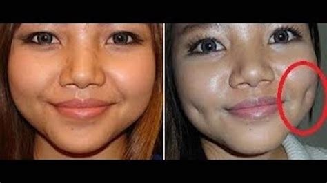Top Ways To Get Dimples Naturally On Your Cheeks Dimples Skin