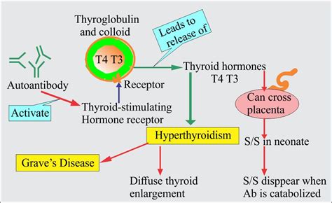 Chapter 23 Autoimmune Diseases Hashimotos Thyroiditis And Graves