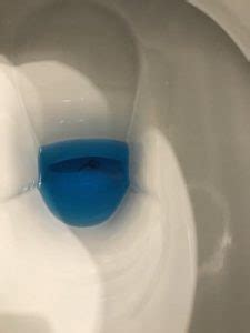 It could be because there are tiny baby worms in your stomach. Worm Found in Toilet in Central Europe - All About Worms