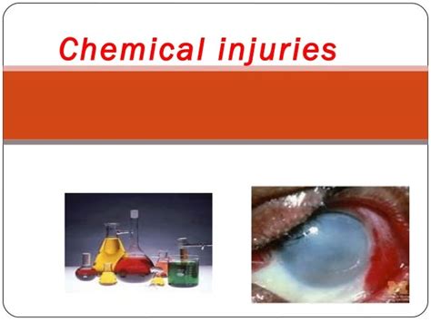 Seminar Chemical Injuries
