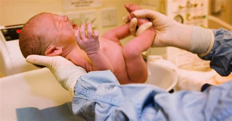 Circumcision Rates Declining In Us Infants Raising Health Risks