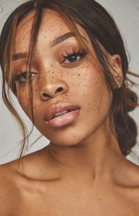 Queenmaira Beautiful Freckles Black Girls With Freckles Women With Freckles