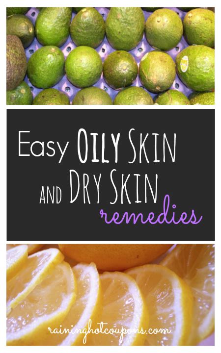 Easy Dry Skin And Oily Skin Remedies Recipe Skin Remedies Oily