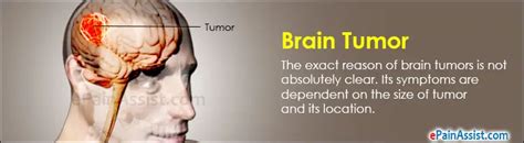 Brain Tumortypesgradescausessignssymptomstreatment