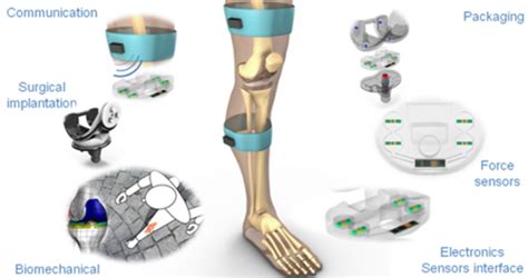 Prothèses Médicales Intelligentes Une Nouvelle étape Franchie Knee