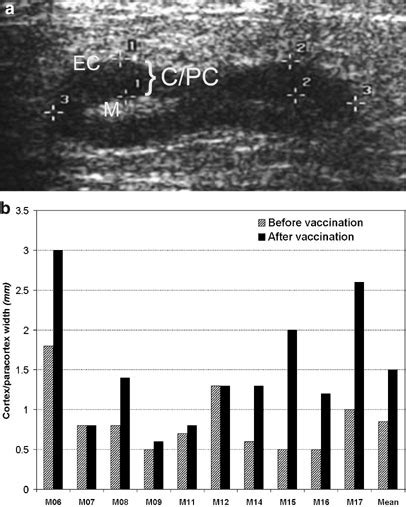 Ultrasound Monitoring Of Lymph Nodes Receiving Vaccine Injections At