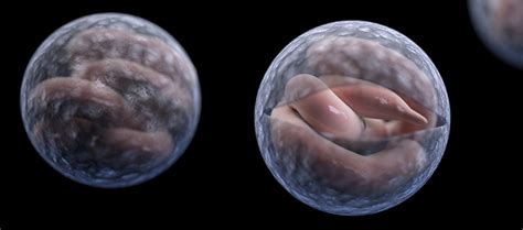 To create revolutionary solutions with diverse and. Parasites - Cryptosporidium (also known as "Crypto ...