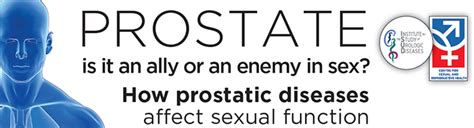 Prostate Is It An Ally Or An Enemy In Sex Isud