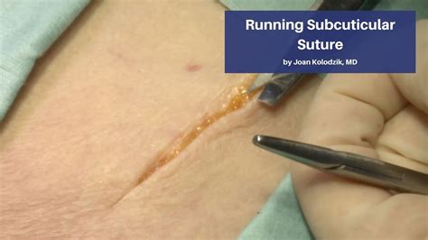 Running Subcuticular Suture The Cadaver Based Suturing Self‑study