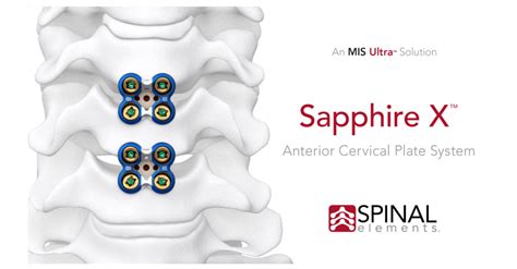 Spinal Elements Announces 100th Case With Sapphire X Anterior