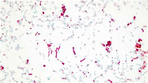 Micrograph Bacillus Megaterium 5d Endospore 1000x P000066 Oer Commons