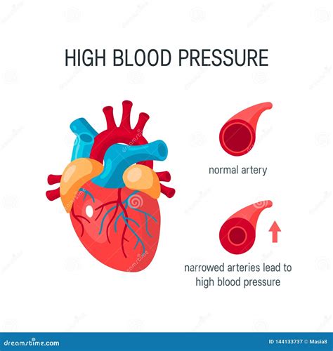 Blood Pressure Concept In Flat Style Vector Stock Vector