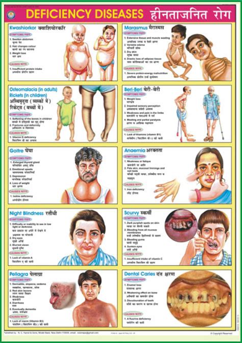 18 Unique Vitamin And Mineral Deficiency Symptoms Chart Chart Gallery