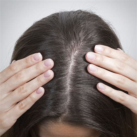 Itchy Scalp Causes And Treatments How To Diagnose Itching And Dandruff All Things Hair Uk