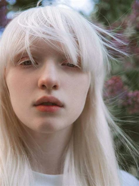 Nastya Kumarova Fae Pinterest Albinism And Face