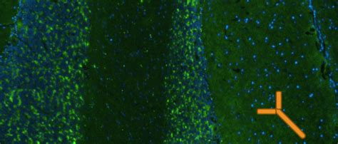 B Cell Mediated Immune Response In Gad Antibody Associated Neurological