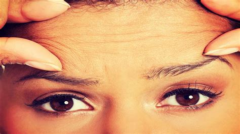 Time To Set Your Forehead Wrinkle Free With Home Remedies